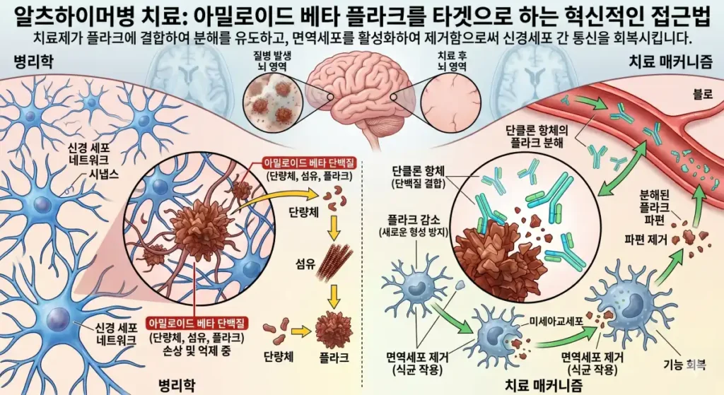 아밀로이드 베타 단백질의 치료 매커니즘을 보여주는 이미지